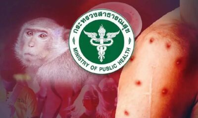 จำนวนผู้ป่วยโรคฝีลิง (Mpox) ในประเทศไทยทะลุ 1,000 รายตั้งแต่ปี 2022