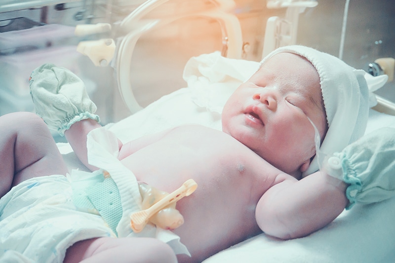 กรมอนามัยเตือน ไทยคลอดก่อนกำหนดพุ่ง 9.91% สูงกว่าค่าเฉลี่ยโลก