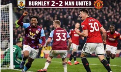 เบิร์นลีย์ พบ แมนยู