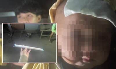 พ่อชาวเชียงใหม่ถูกจับกุมหลังทำร้ายลูกน้อยด้วยท่อพลาสติก