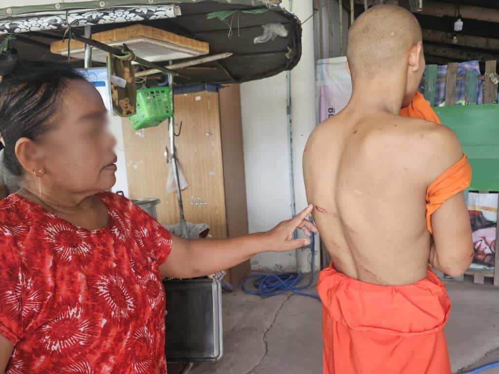 พระวัดดังกำแพงเพชรทารุณสามเณรวัย 14 ปี ใช้บุหรี่จี้แผ่นหลัง