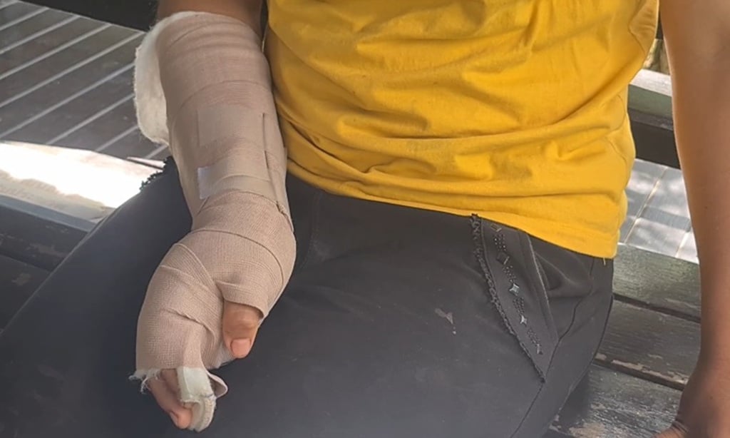 หญิงเรียกร้องความเป็นธรรมหลังถูกสามีติดเหล้าทำร้ายอย่างโหดเหี้ยม