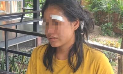หญิงเรียกร้องความเป็นธรรมหลังถูกสามีติดเหล้าทำร้ายอย่างโหดเหี้ยม