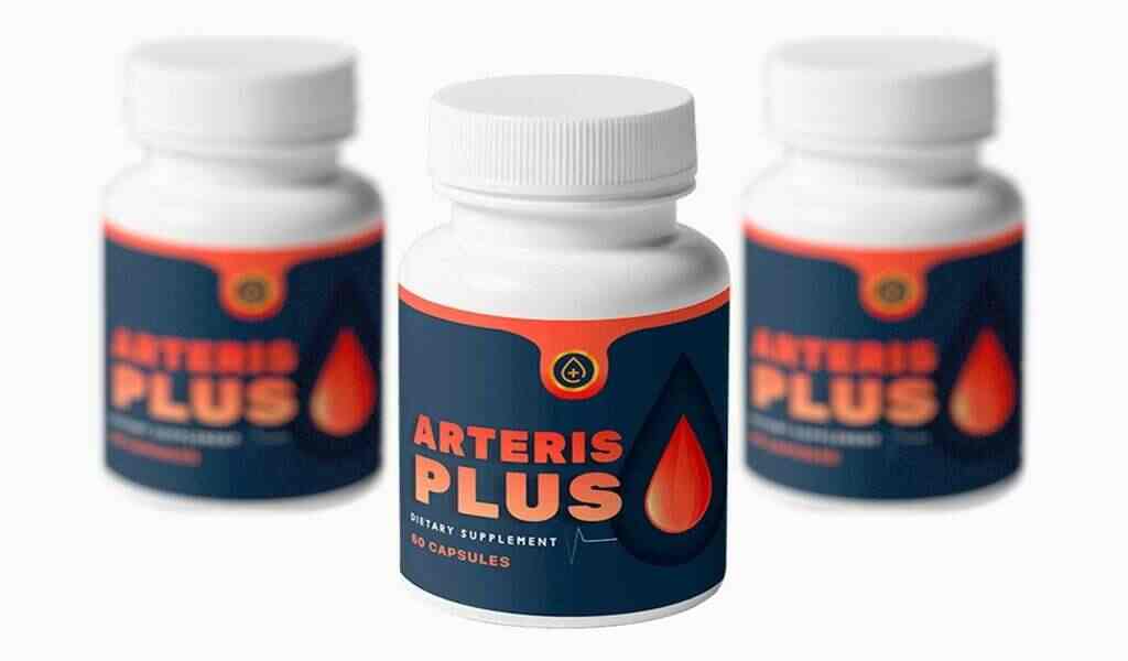 Arteris-Plus