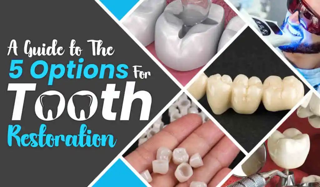 Tooth restorations