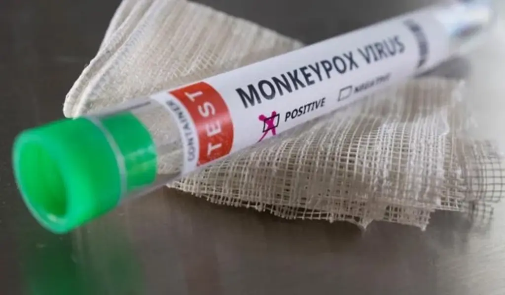 Health Authorities Declared A High Alert To Check Monkeypox Suspected Cases 155 Health Authorities Declared A High Alert To Check Monkeypox Suspected Cases