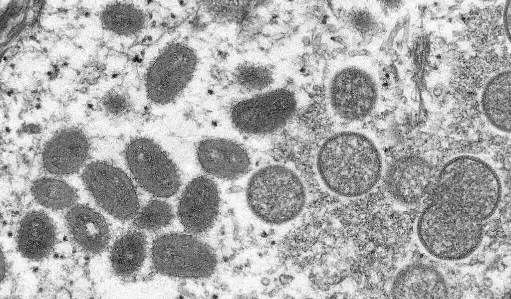Kerala Should Be Vigilant, Officials Should Create Awareness On Monkeypox Disease Health Minister