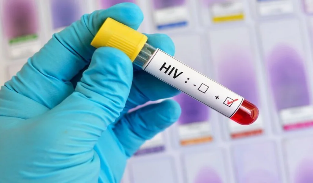 HIV Testing - Here's What You Need To Know