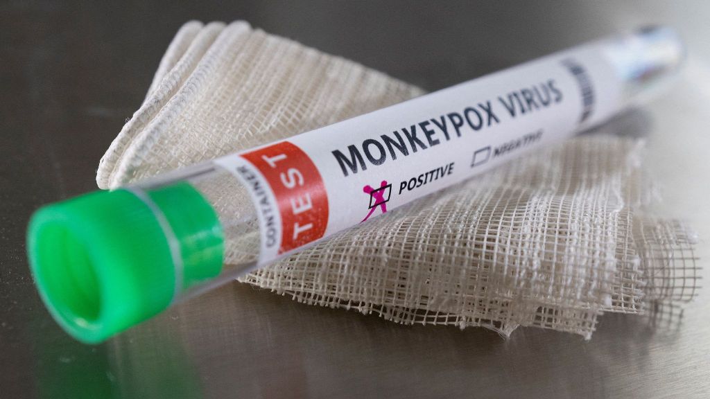 47-Year-Old Man In Bangkok Diagnosed With Monkeypox 156 47-Year-Old Gay Man in Bangkok Diagnosed with Monkeypox