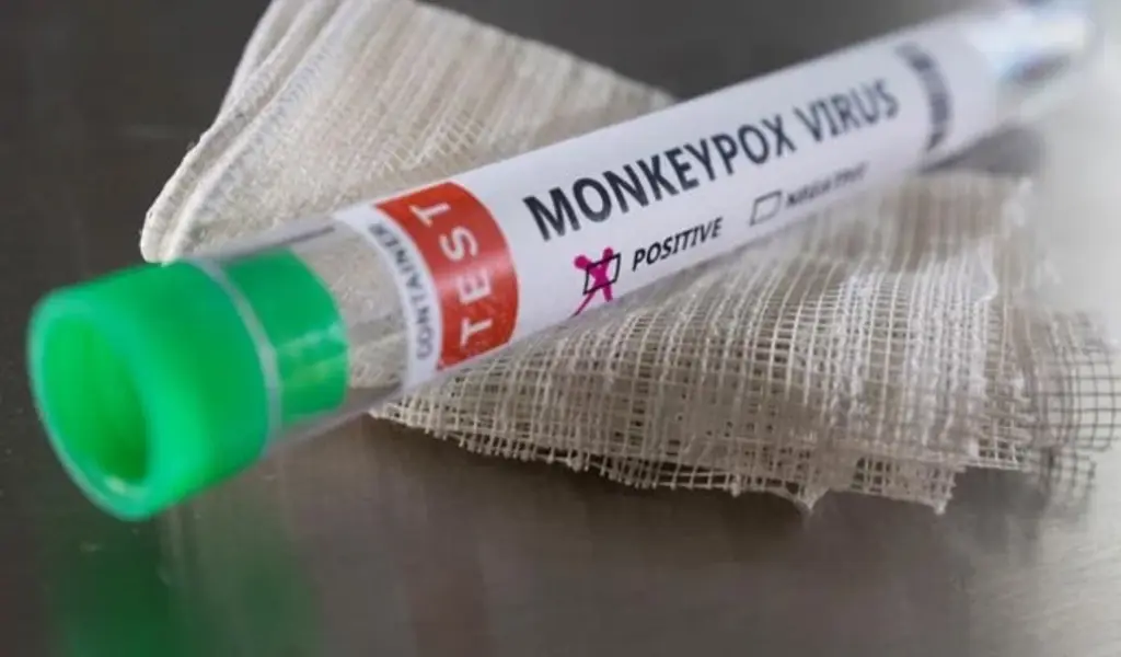 First Case Of Monkeypox Identified In Children In The U.S.