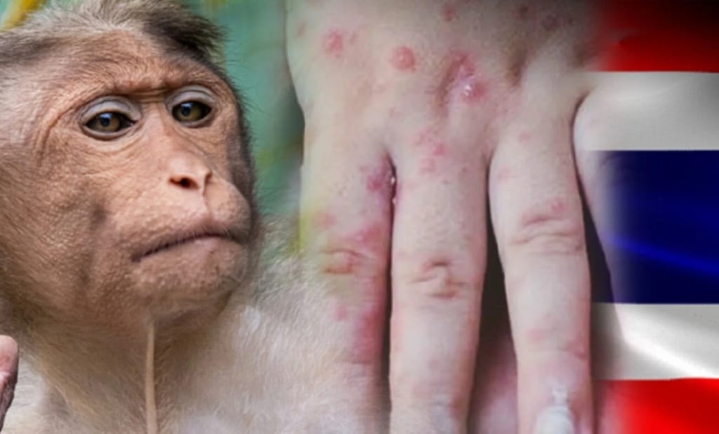 Public in Thailand Urged to Stay Calm Over Monkeypox