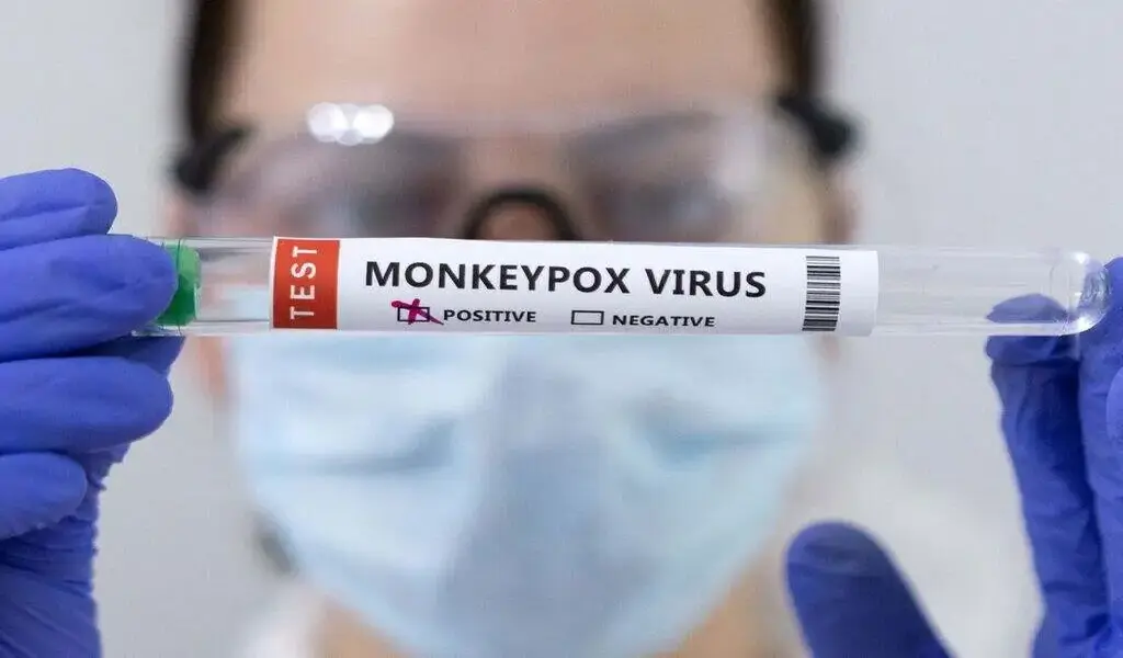 Thailand's Second Monkeypox Case Found In Bangkok