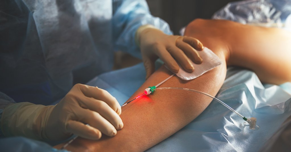5 Top Reasons You Need The Best Vascular Surgeon 156 5 Top Reasons You Need the Best Vascular Surgeon