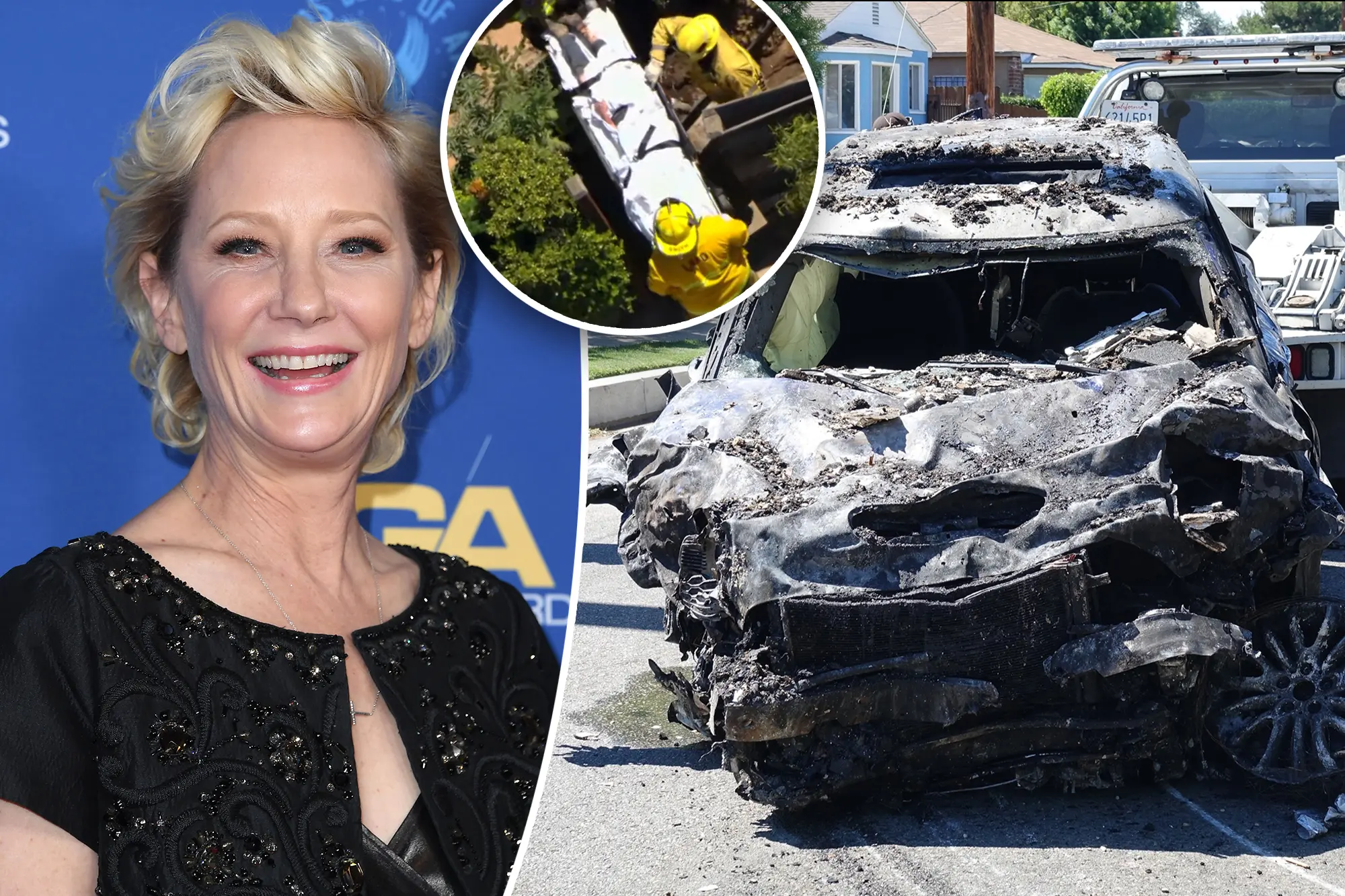 Anne Heche Remains In Coma After Fiery Crashing Into House 157 Anne Heche Remains in Coma After Crashing Her Car into House