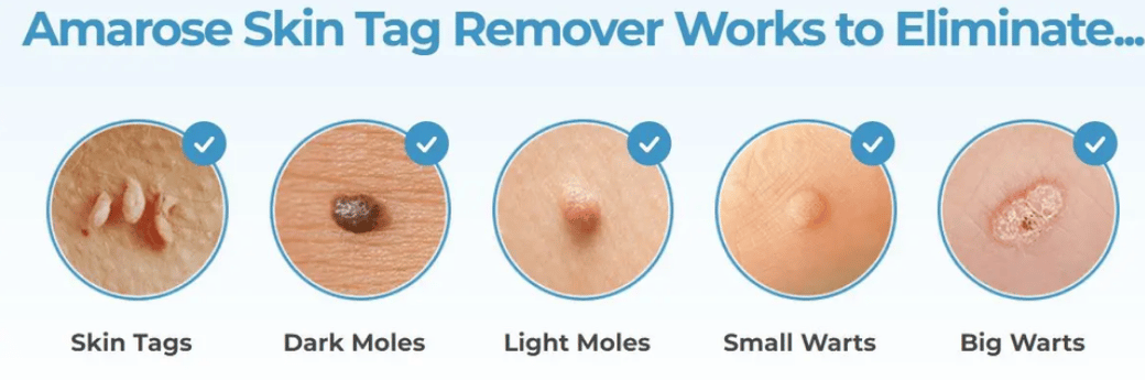 https://worldmuscleking.com/wp-content/uploads/2022/09/Amarose-Skin-tag-remover-3.png
