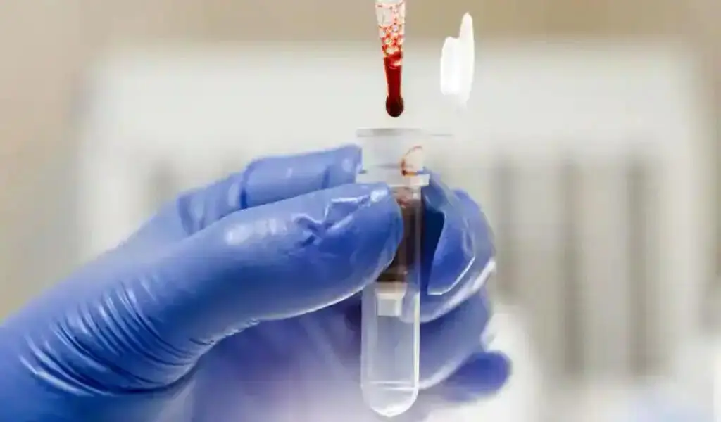 Blood Grown In The Lab Given To Humans In The First-ever Trial Aiming At Combating Rare Diseases