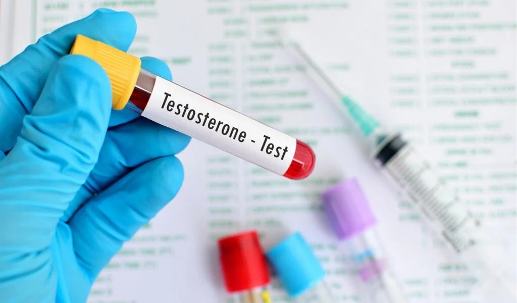 How to Test Your Testosterone Levels