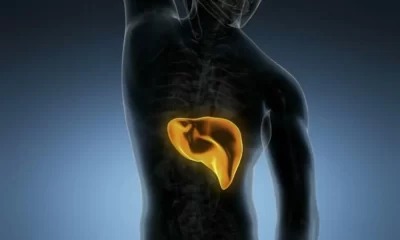 The Pancreatic Cancer Rate Is Rising - Healthwatch 16