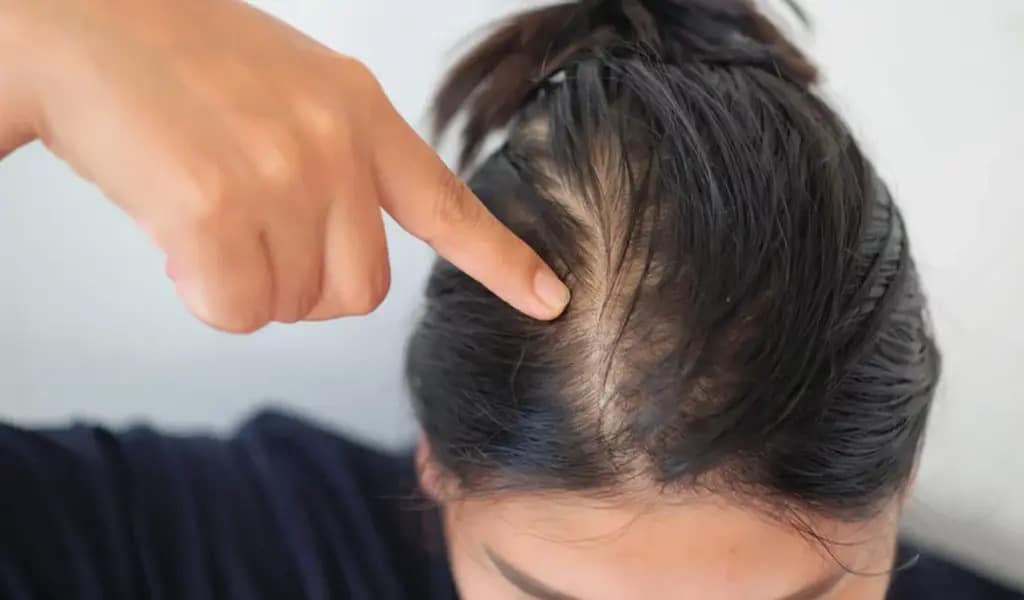 How Much Hair Loss Should You Normally have In A Day?
