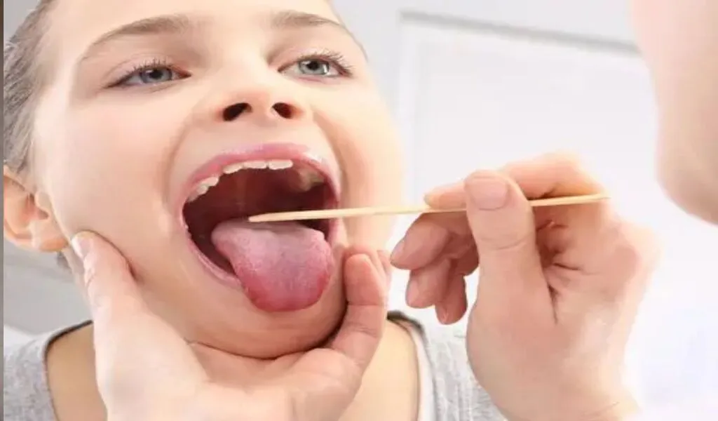 Winter Tonsils Can Cause Cancer So Dont Ignore Them