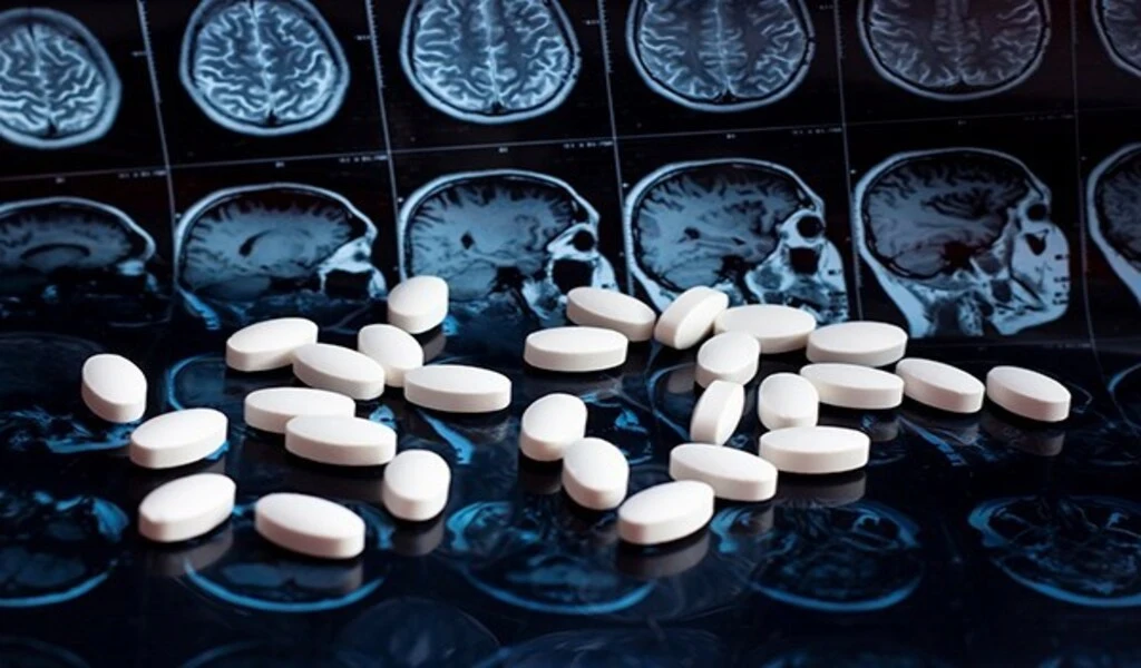 US Approves Alzheimer's Drug That Slows The Disease Significantly