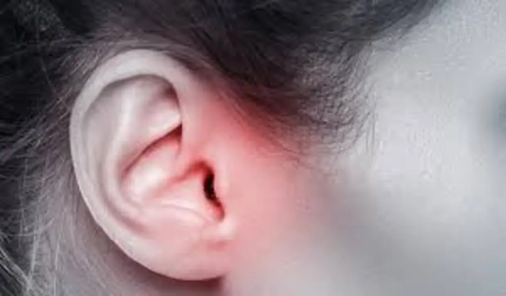 Symptoms and Treatment of Ear Infection