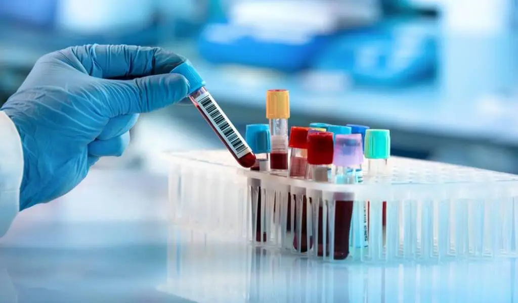 Understanding Blood Tests Everything You Need To Know CTN News