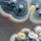 Deadly Fungus Candida Auris Spreading Rapidly in US, CDC Warns