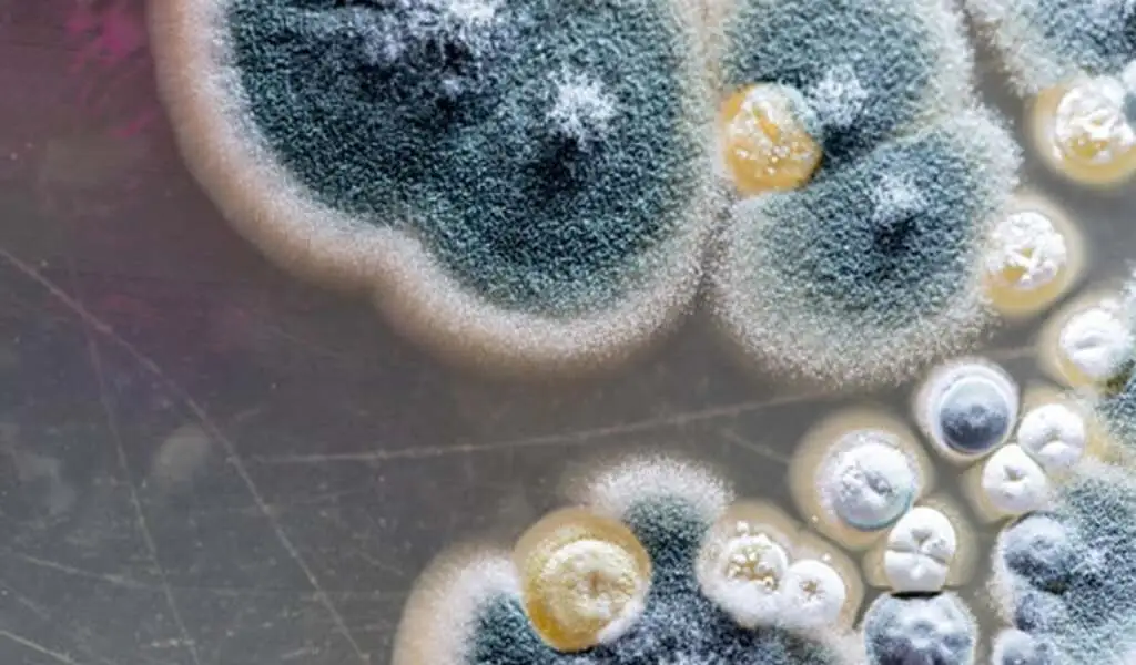 Deadly Fungus Candida Auris Spreading Rapidly in US, CDC Warns