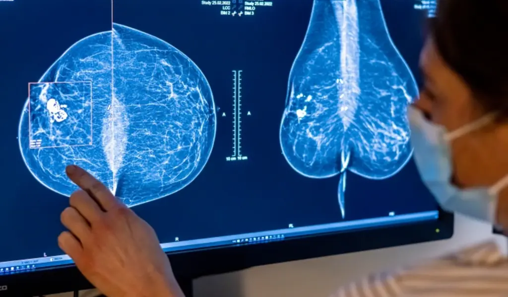 breast density