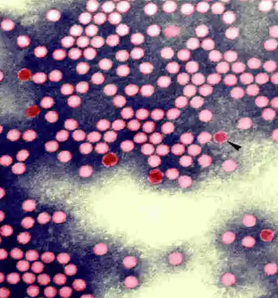 Polio Is Back In Rockland Wastewater. Meaning Of The Term