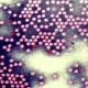 Polio Is Back In Rockland Wastewater. Meaning Of The Term