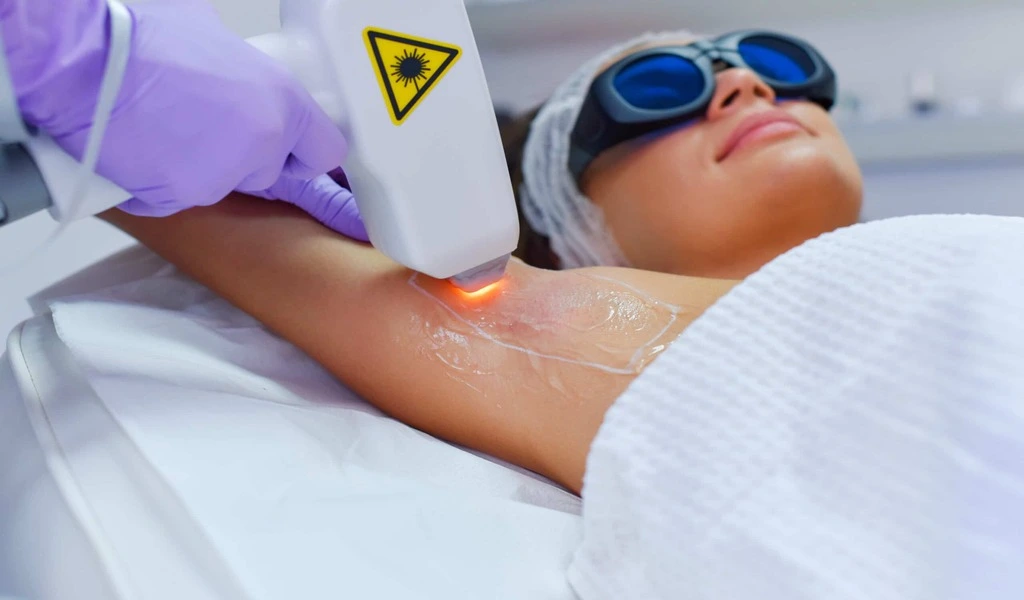 High Quality Laser Hair Removal