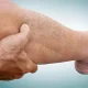 Use Of Smokeless Tobacco Linked To Peripheral Artery Disease