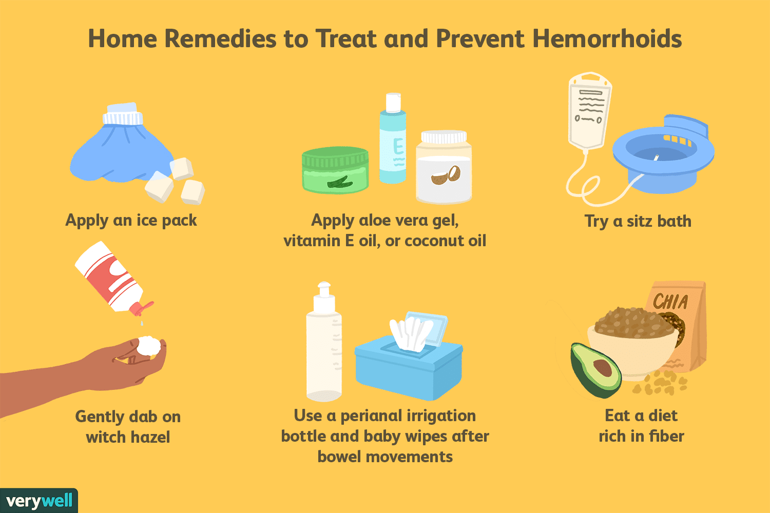 Home Remedies for External Hemorrhoids