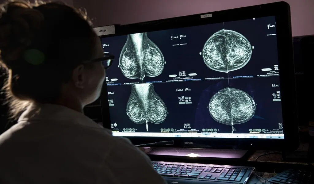 Breast Cancer Screenings Why Starting at Age 40 is Crucial for Early Detection