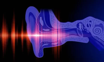 Gene Therapy Breakthrough For Aging-Related Hearing Loss