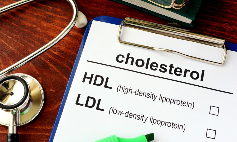 Understanding Your Cholesterol Test Results CTN News
