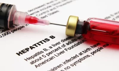 Hepatitis B Testing Advised For Body Piercing Clients At Calgary Studio
