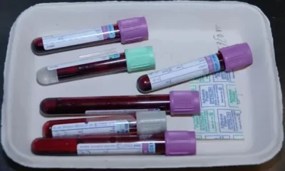 Study Suggests Blood Tests Could Speed Up Cancer Diagnosis For 50 Types