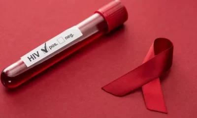 13% Of HIV-Infected People Are Unaware Of Their Infection