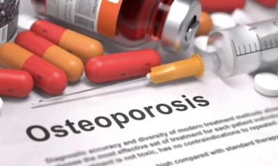 Osteoporosis Is A Female Disease That Shouldn't Be Overlooked By 'Him'