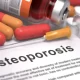 Osteoporosis Is A Female Disease That Shouldn't Be Overlooked By 'Him'
