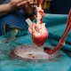 Heart transplantation