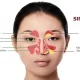 What You Need To Know About Sinus Infections And How To Treat Them