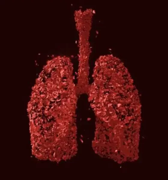 Lung Bacterial Colonization Is Also Influenced By The Host Genome