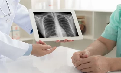 What is Diagnosis for Pneumonia, Thesis Writing & term Paper Writing Help
