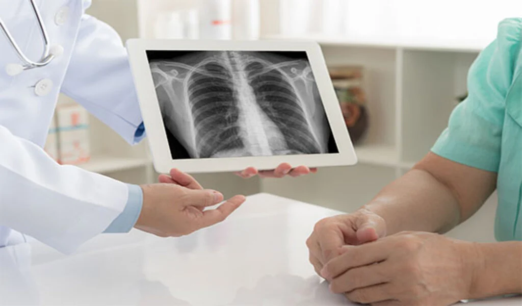 What is Diagnosis for Pneumonia, Thesis Writing & term Paper Writing Help