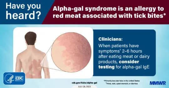 alpha gal syndrome11