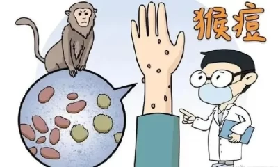 An Outbreak Of Monkeypox Has Been Confirmed In Liaoning Province